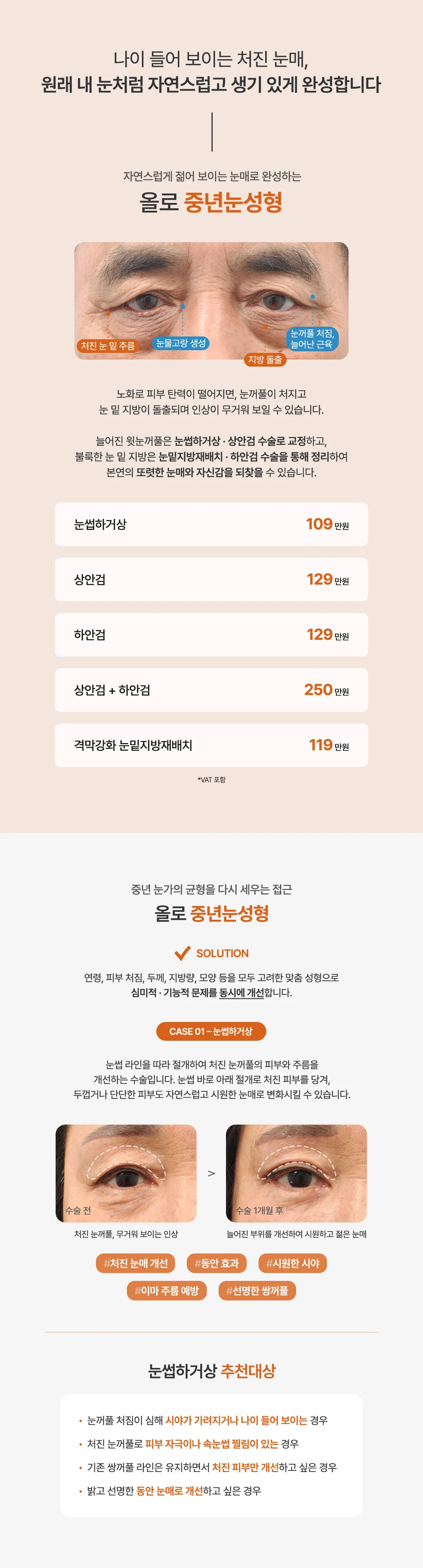올로 중년눈성형 가격 안내 및 눈썹하거상